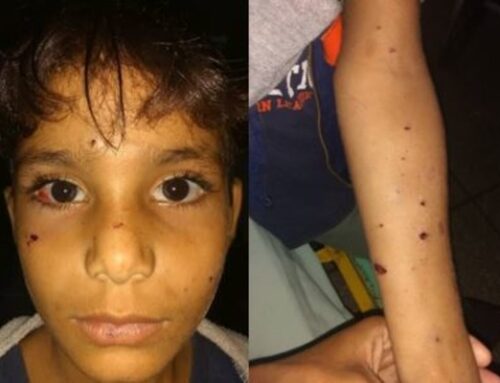 NIÑOS HERIDOS POR EXPLOSIVOS EN ZONA MILITAR ABANDONADA