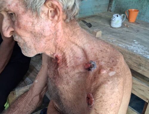 CON CARCINOMA Y SIN TRATAMIENTO